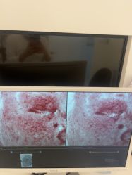 -苑苑vbeauty科技美容SPA