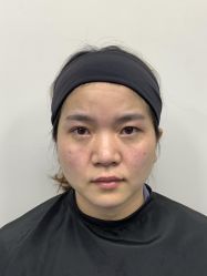 -广州健丽·去眼袋医疗美容机构