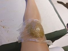 -天然沐足·推背采耳·敷姜艾灸(龙眼美食街店)