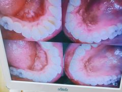 -爱牙联合口腔(门诊报销 海云庵店)