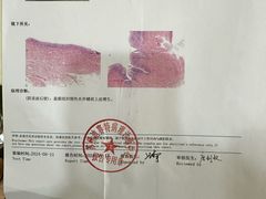 -上海仁爱医院