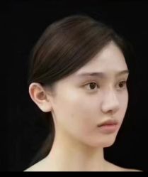 -郡艺医疗美容·微整·眼鼻吸脂