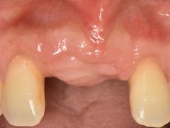 -精德口腔·种植修复·儿牙中心(财富中心店)