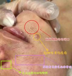 -MLP美丽派·问题肌疗愈中心