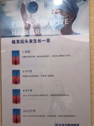 点击看大图 -碧莲盛·不剃发植发