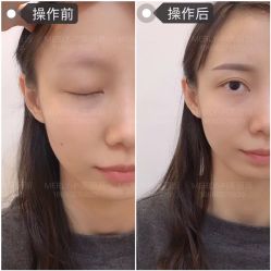 -MLP美丽派·问题肌疗愈中心