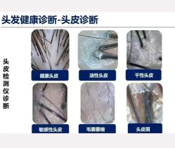 -希梵尔头皮抗衰·科技养发