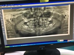 -天使口腔门诊部(上海店)