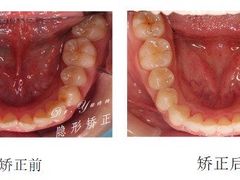 -Dr.Z dental仁康种植矫正中心
