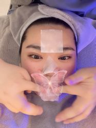 体验后-纯粹医美