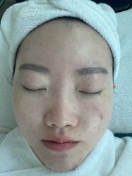 -睿明真达专业皮肤护理中心