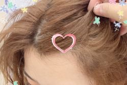 -大麦微针植发全国连锁