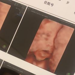 -杭州贝瑞斯美华妇儿医院·早孕·产检·儿科