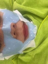 -苗医生草本科技祛痘