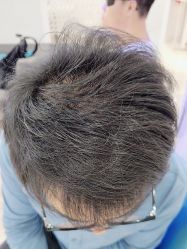 -雍禾植发全国连锁