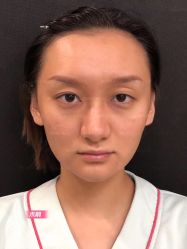 -北京米扬丽格医疗美容·联合丽格鼻整形中心