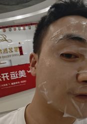 体验后-郡艺医疗美容·微整·眼鼻吸脂