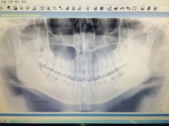 -爱贝口腔·牙周诊疗·种植修复中心