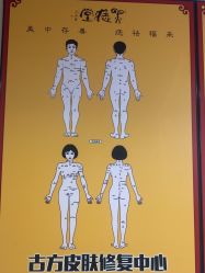 -北京美痣堂古方祛痣斑疣瘊
