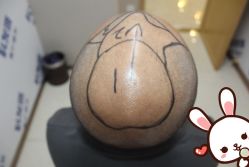 点击看大图 -大麦微针植发丨全国连锁