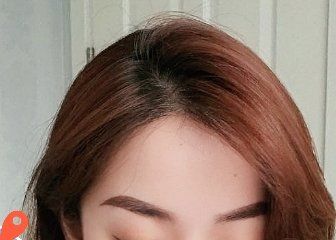 -大麦微针植发丨全国连锁