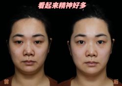 -深圳艺星医疗美容医院