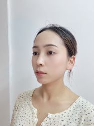 -四川米兰柏羽医学美容医院