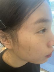 -长沙雅美医疗美容医院