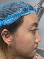 -安徽合肥韩美整形外科医院