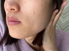 -大连市皮肤病医院