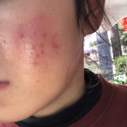 -杭州医巢医疗美容
