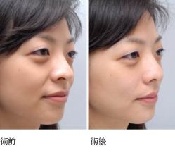 -CMS西美斯·美式医疗美容