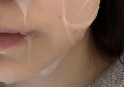 体验前-杭州米兰柏羽医疗美容医院