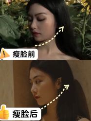 -广州健丽·去眼袋医疗美容机构