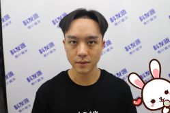 -大麦微针植发丨全国连锁