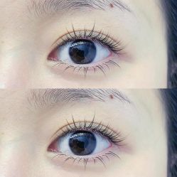 -宥莉·ULLY 痘敏肌•科技皮肤管理中心