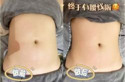 -Lily纤美·科技减脂中心
