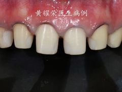 -柏乐口腔(南宁总院)