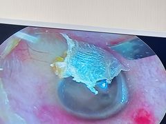 -溥耳·可视采耳·头疗·沐眼