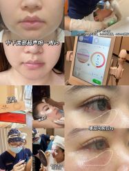 -肌密·水光·祛痘·黄金微针