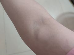 -悦检(珠江医院体检中心)