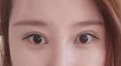 -天津健丽·去眼袋医疗美容机构