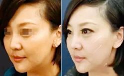 -SKINIST丽铂医疗美容