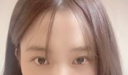 -天津健丽·去眼袋医疗美容机构