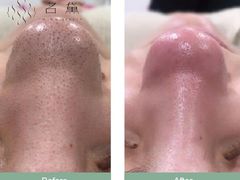 -太原凯宾斯基饭店