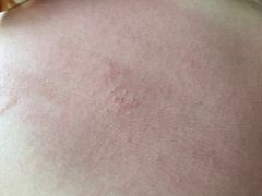 -深圳鑫泽盲人按摩中心(华讯中心店)