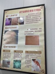 -苗方清颜专业祛痘·皮肤管理