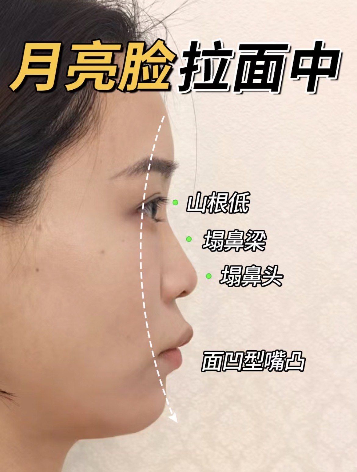 凹面型月亮脸怎么do!