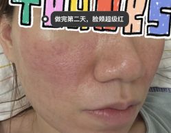 -恒妍医美·韩国定制抗衰中心