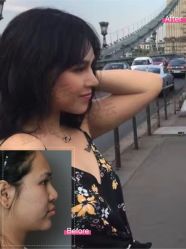 -北京米扬丽格医疗美容·联合丽格鼻整形中心